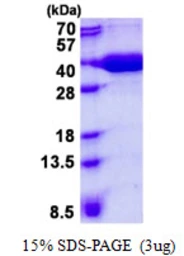 Human PFDN3 protein, His tag. GTX67936-pro