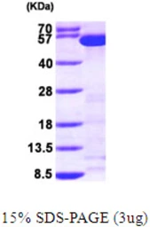 Human Tryptophanyl tRNA synthetase protein, His tag. GTX67939-pro