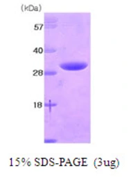 Human 14-3-3 eta protein, His tag. GTX67945-pro