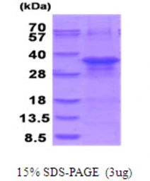 Human ZFAND5 protein, His tag. GTX67950-pro