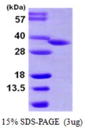 Human HSD17B8 protein, His tag. GTX67955-pro