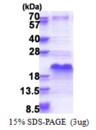 Human DSS1 protein, His tag. GTX67959-pro