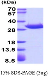 Human ANP32A protein, His tag. GTX67965-pro