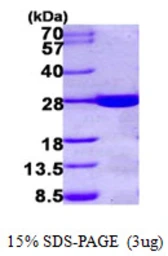 Human GS1 protein, His tag. GTX67967-pro