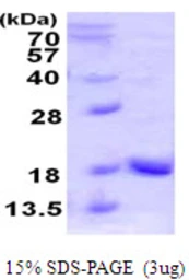 Human UBL4A protein, His tag. GTX67969-pro