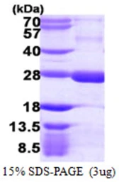 Human RGS5 protein, His tag. GTX67975-pro