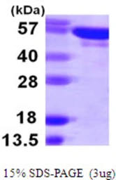 Human Tyrosyl tRNA synthetase protein, His tag. GTX67980-pro