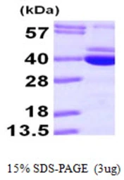 Human PDXK protein, His tag. GTX67981-pro