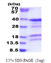 Human PACT protein, His tag. GTX67982-pro