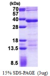 Human RFXANK protein, His tag. GTX67986-pro