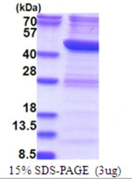 Human RTCD1 protein, His tag. GTX67987-pro