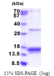 Human 4E-BP3 protein, His tag. GTX67988-pro