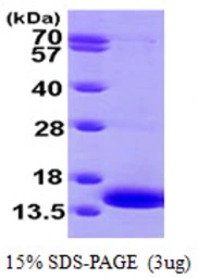 Human MP1 protein, His tag. GTX67989-pro