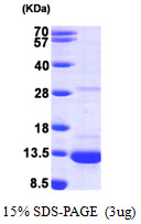 Human DYNLL1 protein, His tag. GTX67990-pro