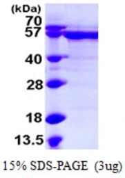 Human RNMT protein, His tag. GTX67999-pro