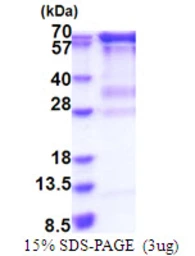 Human HCE protein, His tag. GTX68000-pro