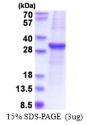 Human SOCS3 protein, His tag. GTX68020-pro