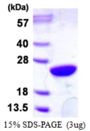 Human UBE2M protein, His tag. GTX68022-pro