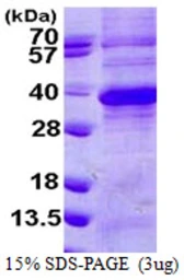 Human Regucalcin protein, His tag. GTX68027-pro
