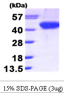 Human Aurora B protein, His tag. GTX68034-pro