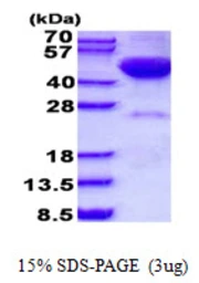 Human DRAK2 protein, His tag. GTX68038-pro