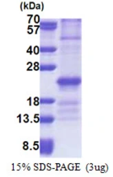 Human ZNHIT3 protein, His tag. GTX68046-pro