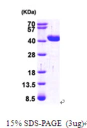 Human GRHPR protein, His tag. GTX68050-pro