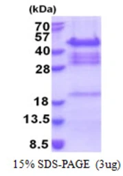 Human QKI protein, His tag. GTX68058-pro