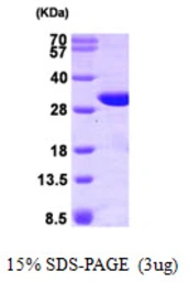 Human GSTO1 protein. GTX68059-pro