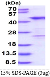 Human Homer3 protein, His tag. GTX68061-pro