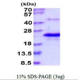 Human LITAF protein, His tag. GTX68069-pro