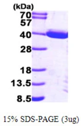 Human PIG3 protein, His tag. GTX68076-pro