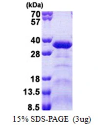 Human SPAG7 protein, His tag. GTX68078-pro