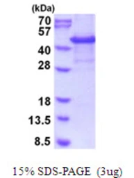 Human PSCDBP protein, His tag. GTX68081-pro