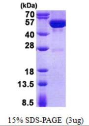 Human Guanine deaminase protein, His tag. GTX68082-pro