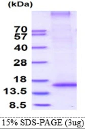 Human RNF7 protein, His tag. GTX68083-pro