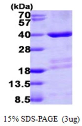 Human Mortality factor 4 like 2 protein, His tag. GTX68085-pro