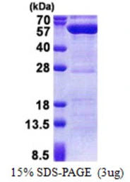 Human PPM1F protein, His tag. GTX68086-pro
