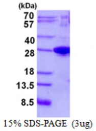 Human JOSD1 protein, His tag. GTX68094-pro