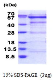 Human OXSR1 protein, His tag. GTX68096-pro
