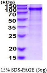 Human UBA2 protein, His tag. GTX68107-pro