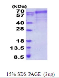 Human FARSB protein, His tag. GTX68109-pro