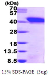 Human Snurportin 1 protein, His tag. GTX68110-pro