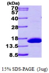 Human HRSP12 protein, His tag. GTX68130-pro