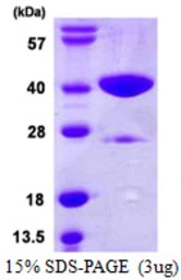 Human GLYAT protein, His tag. GTX68132-pro