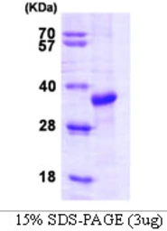 Human STUB1 protein. GTX68134-pro