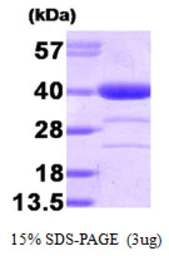 Human AKR1A1 protein. GTX68142-pro