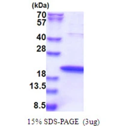 Human ZNHIT1 protein, His tag. GTX68156-pro