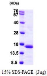 Human PFDN6 protein, His tag. GTX68157-pro