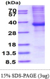 Human HOXB13 protein, His tag. GTX68161-pro